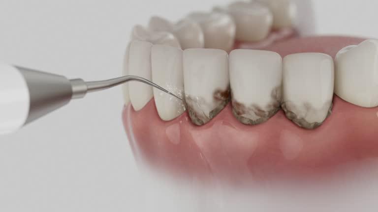 Trusted Teeth Cleaning And Checkup service in Dexter, NM - Dentist Open Now